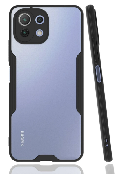 Newface Xiaomi Mİ 11 Lite Kılıf Platin Silikon - Siyah resmi