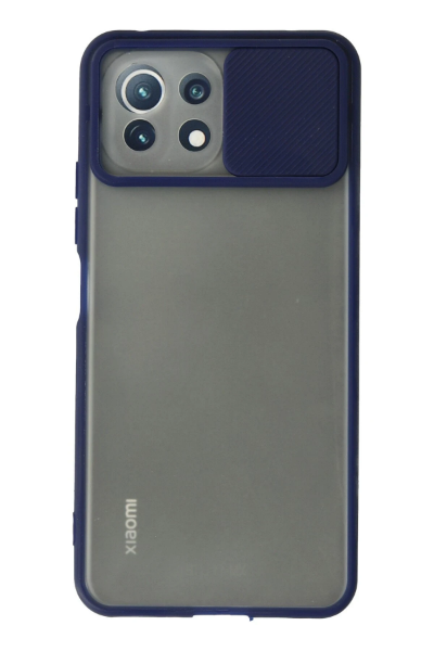 Newface Xiaomi Mİ 11 Lite Kılıf Palm Buzlu Kamera Sürgülü Silikon - Lacivert resmi