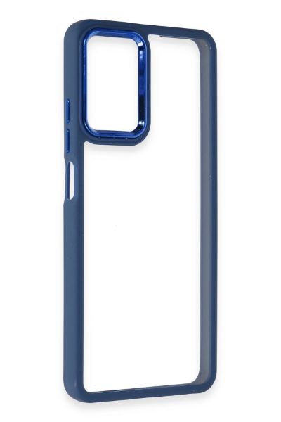 Newface Realme 10 Pro 5G Kılıf Dora Kapak - Mavi resmi