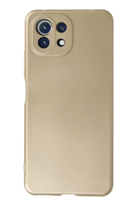 Newface Xiaomi Mİ 11 Lite Kılıf First Silikon - Gold resmi