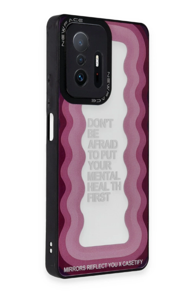 Newface Xiaomi Mi 11T Pro Kılıf Mirror Desenli Kapak - Mirror - 11 resmi