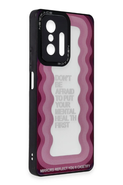 Newface Xiaomi Mi 11T Pro Kılıf Mirror Desenli Kapak - Mirror - 11 resmi