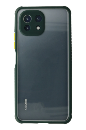 Newface Xiaomi Mİ 11 Lite Kılıf Miami Şeffaf Silikon - Koyu Yeşil resmi
