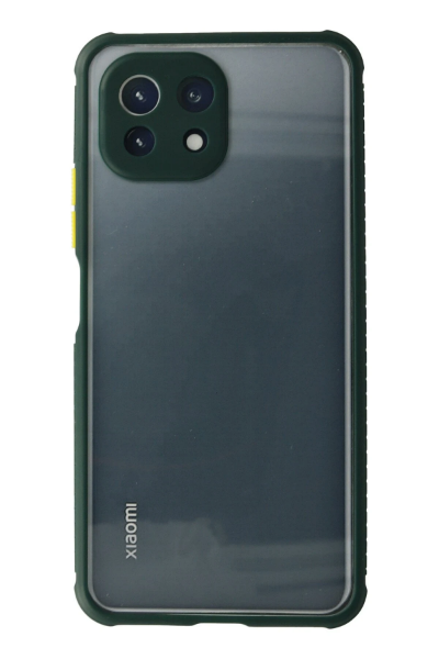 Newface Xiaomi Mİ 11 Lite Kılıf Miami Şeffaf Silikon - Koyu Yeşil resmi