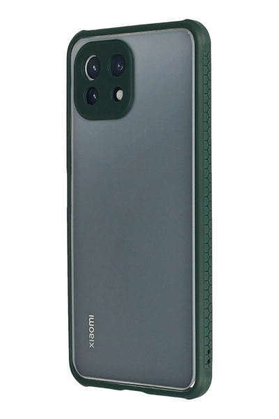 Newface Xiaomi Mİ 11 Lite Kılıf Miami Şeffaf Silikon - Koyu Yeşil resmi