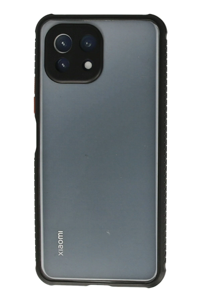 Newface Xiaomi Mİ 11 Lite Kılıf Miami Şeffaf Silikon - Siyah resmi