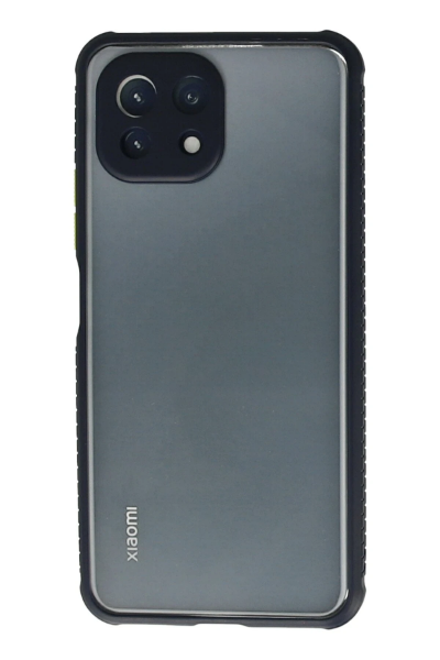 Newface Xiaomi Mİ 11 Lite Kılıf Miami Şeffaf Silikon - Lacivert resmi