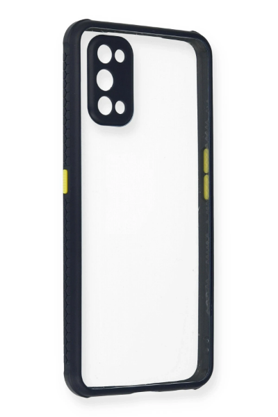 Newface Realme 7 Pro Kılıf Miami Şeffaf Silikon - Lacivert resmi