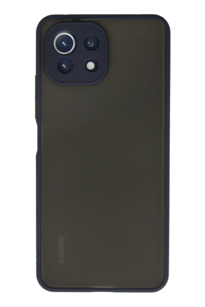 Newface Xiaomi Mİ 11 Lite Kılıf Montreal Silikon Kapak - Lacivert resmi