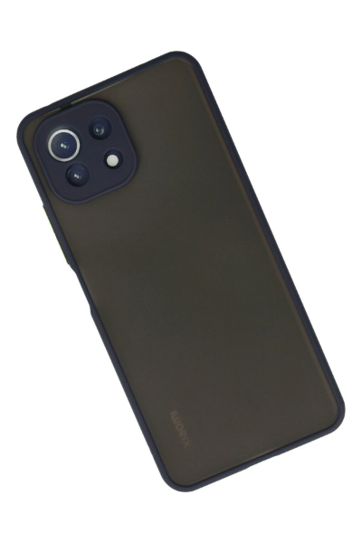 Newface Xiaomi Mİ 11 Lite Kılıf Montreal Silikon Kapak - Lacivert resmi
