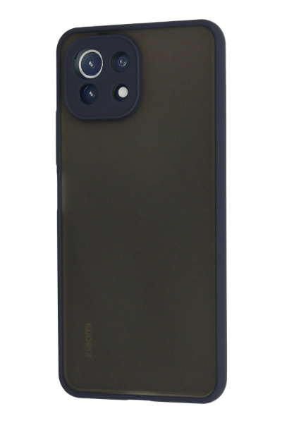 Newface Xiaomi Mİ 11 Lite Kılıf Montreal Silikon Kapak - Lacivert resmi