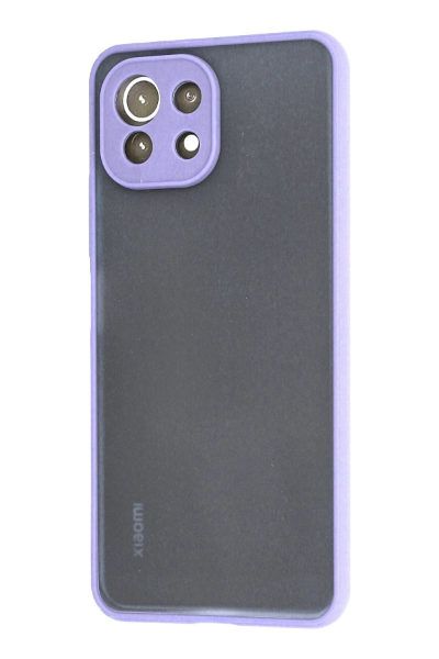 Newface Xiaomi Mİ 11 Lite Kılıf Montreal Silikon Kapak - Mor resmi