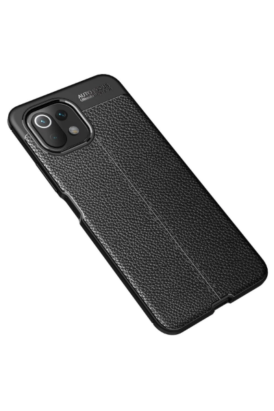 Newface Xiaomi Mİ 11 Lite Kılıf Auto Focus Kapak - Siyah resmi