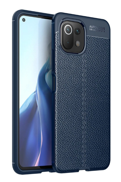 Newface Xiaomi Mİ 11 Lite Kılıf Auto Focus Kapak - Lacivert resmi