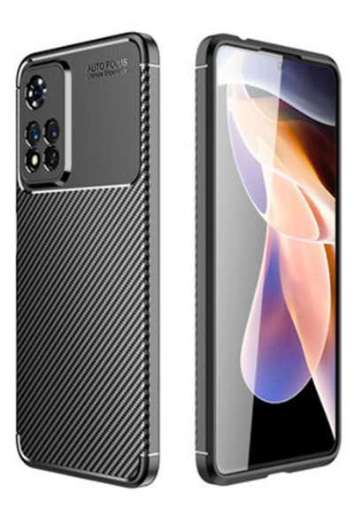 Newface Xiaomi Redmi Note 11 Pro Plus 5G Kılıf Auto Focus Karbon Kapak - Siyah resmi