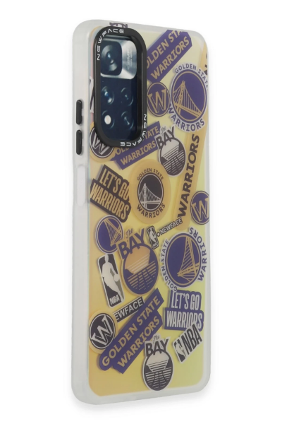 Newface Xiaomi Redmi Note 11 Pro Kılıf Estoril Desenli Kapak - Estoril - 13 resmi