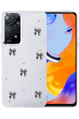 Newface Xiaomi Redmi Note 11 Pro Fiyonk Desenli Kapak - Desen 5 resmi